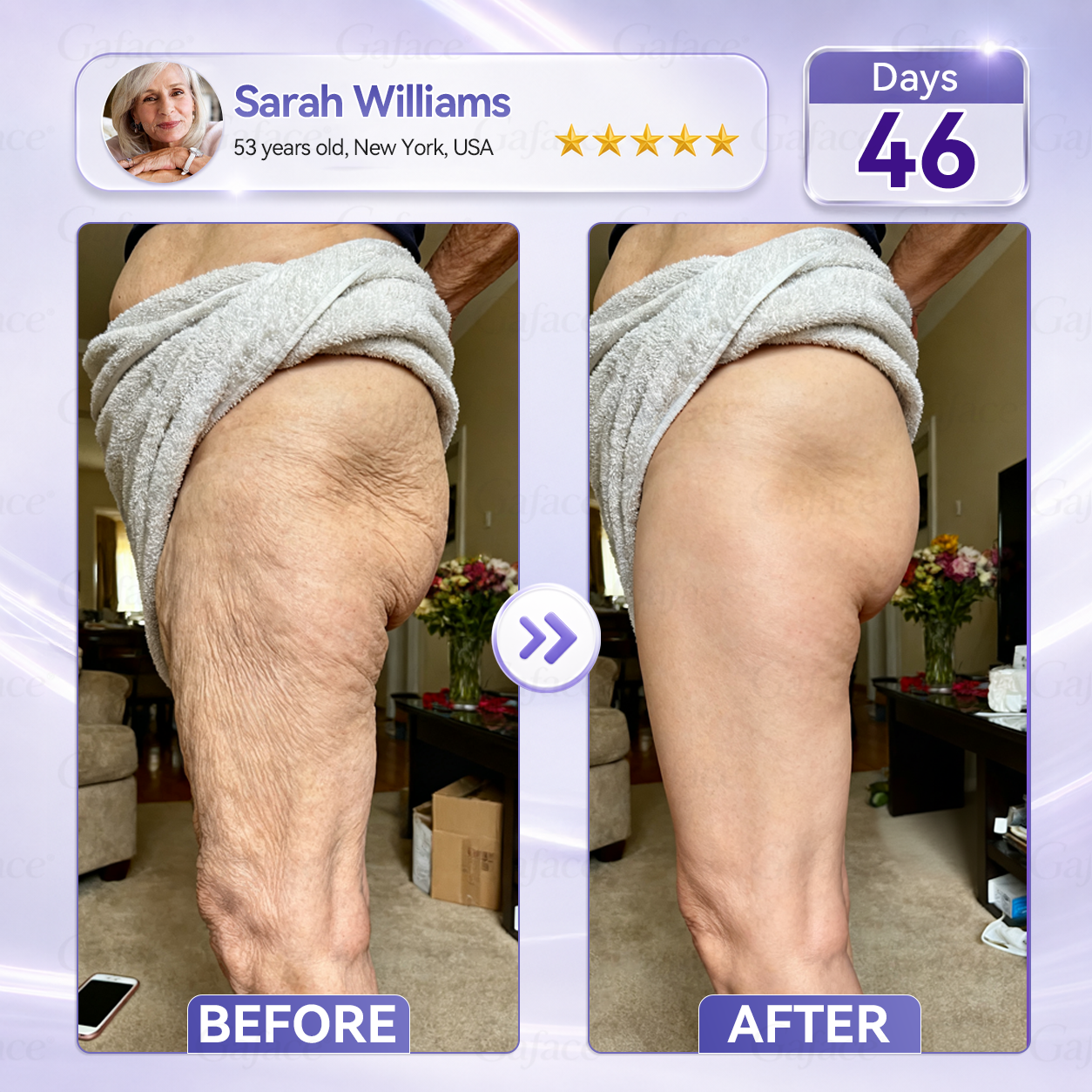 𝐆𝐚𝐟𝐚𝐜𝐞® 𝐂𝐨𝐥𝐥𝐚𝐠𝐞𝐧 & 𝐅𝐮𝐥𝐥𝐞𝐫𝐞𝐧𝐞 𝐑𝐨𝐥𝐥𝐞𝐫 𝐅𝐢𝐫𝐦𝐢𝐧𝐠 𝐂𝐫𝐞𝐚𝐦⏰Enjoy an exclusive 30% discount⏰