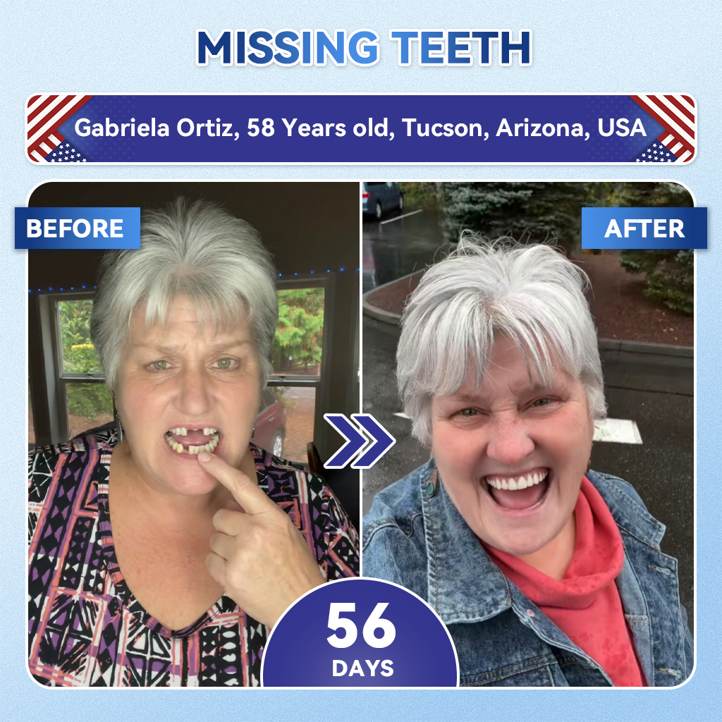 Glimmerly® 🦷 Tideglusib Fast‑Dissolving Tooth & Gum Repair Oral Strips 💥🎉 (Supports tooth repair and helps relieve gum discomfort and other common oral concerns)