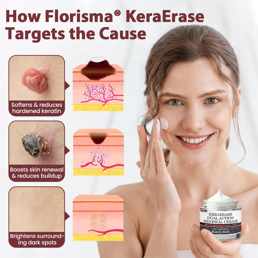 Florisma® KeraErase Dual-Action Renewal Cream – 🛡️Discover smooth, clear, and even-looking skin again with a gentle, botanical formula that targets and renews skin irregularities, skin tags, and keratin buildup without irritation⌛
