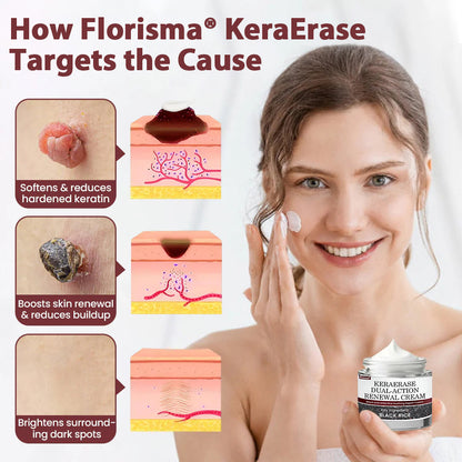 Florisma® KeraErase Dual-Action Renewal Cream – 🛡️Discover smooth, clear, and even-looking skin again with a gentle, botanical formula that targets and renews skin irregularities, skin tags, and keratin buildup without irritation⌛