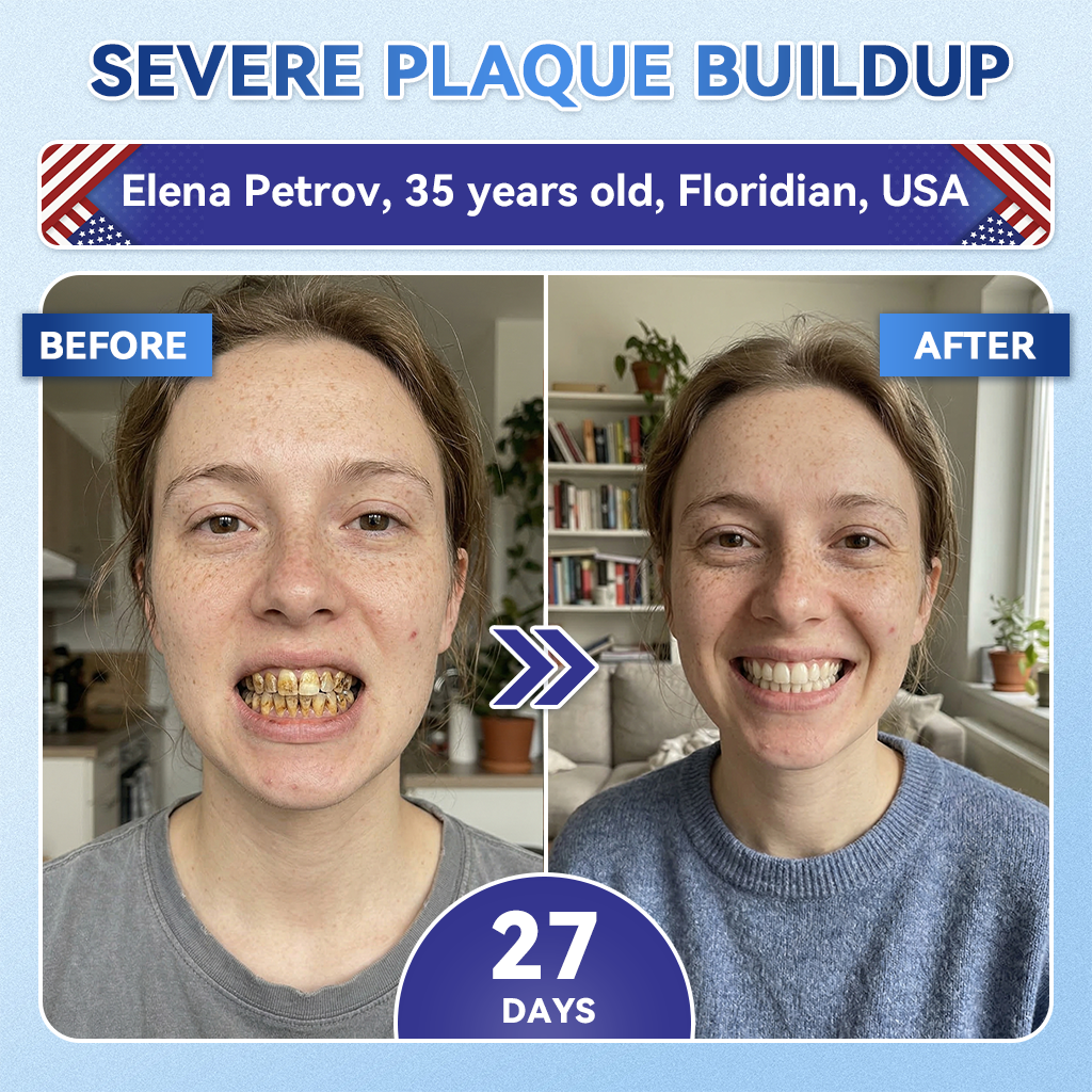 Glimmerly® 🦷 Tideglusib Fast‑Dissolving Tooth & Gum Repair Oral Strips 💥🎉 (Supports tooth repair and helps relieve gum discomfort and other common oral concerns)