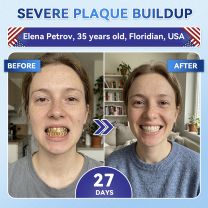 Glimmerly® 🦷 Tideglusib Fast‑Dissolving Tooth & Gum Repair Oral Strips 💥🎉 (Supports tooth repair and helps relieve gum discomfort and other common oral concerns)