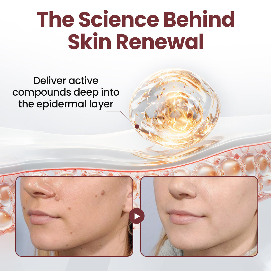 Florisma® KeraErase Dual-Action Renewal Cream – 🛡️Discover smooth, clear, and even-looking skin again with a gentle, botanical formula that targets and renews skin irregularities, skin tags, and keratin buildup without irritation⌛