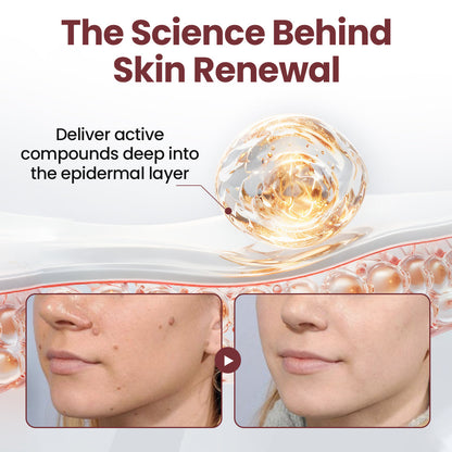 Florisma® KeraErase Dual-Action Renewal Cream – 🛡️Discover smooth, clear, and even-looking skin again with a gentle, botanical formula that targets and renews skin irregularities, skin tags, and keratin buildup without irritation⌛
