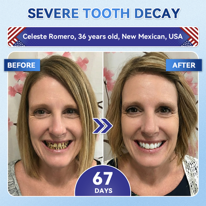 Glimmerly® 🦷 Tideglusib Fast‑Dissolving Tooth & Gum Repair Oral Strips 💥🎉 (Supports tooth repair and helps relieve gum discomfort and other common oral concerns)