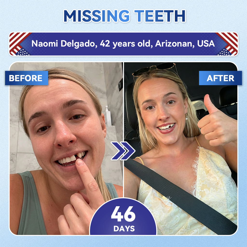 Glimmerly® 🦷 Tideglusib Fast‑Dissolving Tooth & Gum Repair Oral Strips 💥🎉 (Supports tooth repair and helps relieve gum discomfort and other common oral concerns)