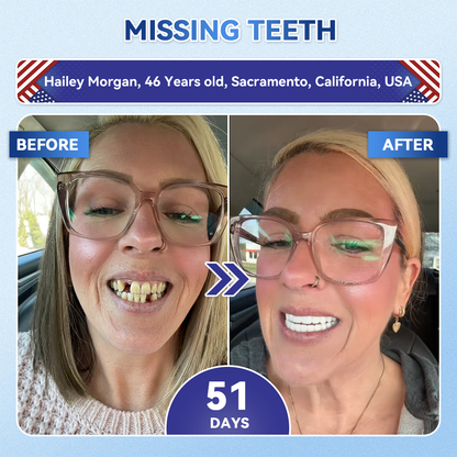 Glimmerly® 🦷 Tideglusib Fast‑Dissolving Tooth & Gum Repair Oral Strips 💥🎉 (Supports tooth repair and helps relieve gum discomfort and other common oral concerns)