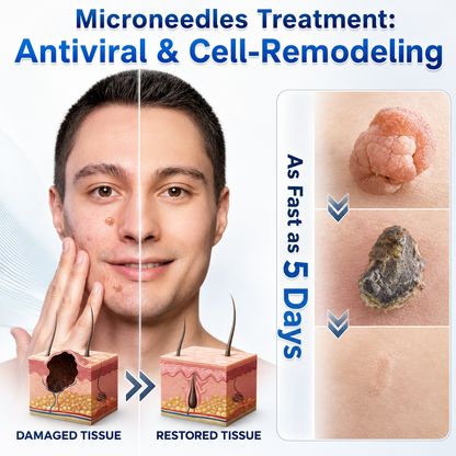 👩‍⚕️💎 𝐎𝐟𝐟𝐢𝐜𝐢𝐚𝐥 𝐒𝐭𝐨𝐫𝐞 | 𝑵𝐞𝒌𝐢𝐬𝐬® 🌿 𝐁𝐨𝐭𝐚𝐧𝐢𝐜𝐚𝐥 𝐌𝐢𝐜𝐫𝐨𝐧𝐞𝐞𝐝𝐥𝐞 𝐇𝐲𝐝𝐫𝐨𝐜𝐨𝐥𝐥𝐨𝐢𝐝 𝐏𝐚𝐭𝐜𝐡 (𝐅𝐨𝐫 𝐒𝐤𝐢𝐧 𝐓𝐚𝐠𝐬, 𝐒𝐦𝐚𝐥𝐥 𝐒𝐤𝐢𝐧 𝐆𝐫𝐨𝐰𝐭𝐡𝐬, 𝐖𝐚𝐫𝐭𝐬, 𝐌𝐨𝐥𝐞𝐬, 𝐀𝐠𝐞 𝐒𝐩𝐨𝐭𝐬 & 𝐏𝐢𝐠𝐦𝐞𝐧𝐭𝐚𝐭𝐢𝐨𝐧 𝐂𝐨𝐧𝐜𝐞𝐫𝐧𝐬)
