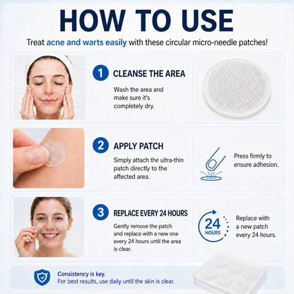 👩‍⚕️💎 𝐎𝐟𝐟𝐢𝐜𝐢𝐚𝐥 𝐒𝐭𝐨𝐫𝐞 | 𝑵𝐞𝒌𝐢𝐬𝐬® 🌿 𝐁𝐨𝐭𝐚𝐧𝐢𝐜𝐚𝐥 𝐌𝐢𝐜𝐫𝐨𝐧𝐞𝐞𝐝𝐥𝐞 𝐇𝐲𝐝𝐫𝐨𝐜𝐨𝐥𝐥𝐨𝐢𝐝 𝐏𝐚𝐭𝐜𝐡 (𝐅𝐨𝐫 𝐒𝐤𝐢𝐧 𝐓𝐚𝐠𝐬, 𝐒𝐦𝐚𝐥𝐥 𝐒𝐤𝐢𝐧 𝐆𝐫𝐨𝐰𝐭𝐡𝐬, 𝐖𝐚𝐫𝐭𝐬, 𝐌𝐨𝐥𝐞𝐬, 𝐀𝐠𝐞 𝐒𝐩𝐨𝐭𝐬 & 𝐏𝐢𝐠𝐦𝐞𝐧𝐭𝐚𝐭𝐢𝐨𝐧 𝐂𝐨𝐧𝐜𝐞𝐫𝐧𝐬)
